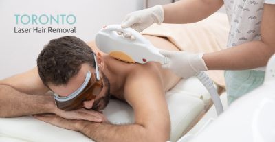 laser hair removal treatments