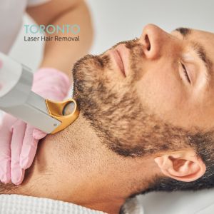 laser hair removal men