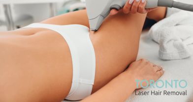 Brazilian laser hair removal Toronto