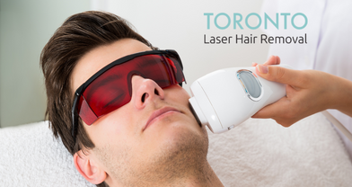 laser hair removal for men