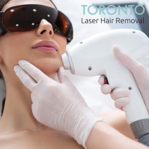 laser hair removal Toronto