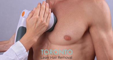What Men Can Expect from Laser Hair Removal Services