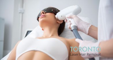 permanent laser hair removal Toronto