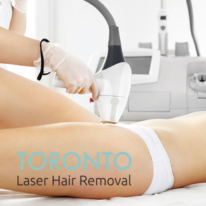 Brazilian laser hair removal