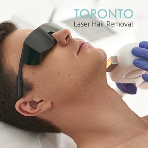 laser hair removal for men