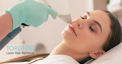 laser hair removal for face