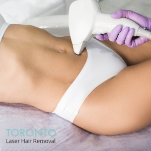 brazilian laser hair removal