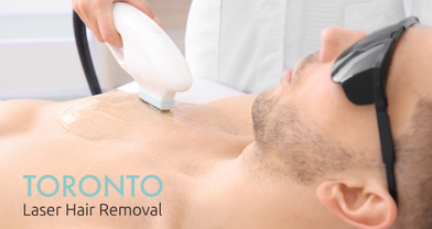 chest laser hair removal for men