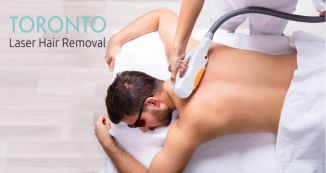 laser hair removal for men Toronto