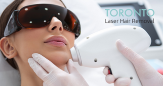 Toronto laser hair removal for face