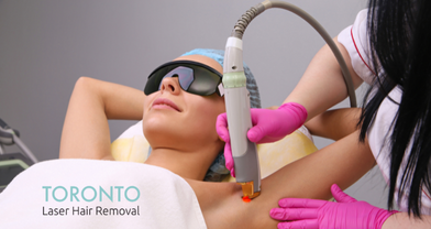 laser hair removal Toronto