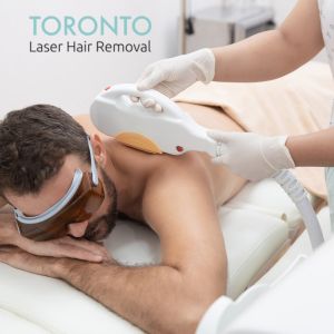 Toronto laser hair removal for men