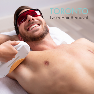 laser hair removal for men