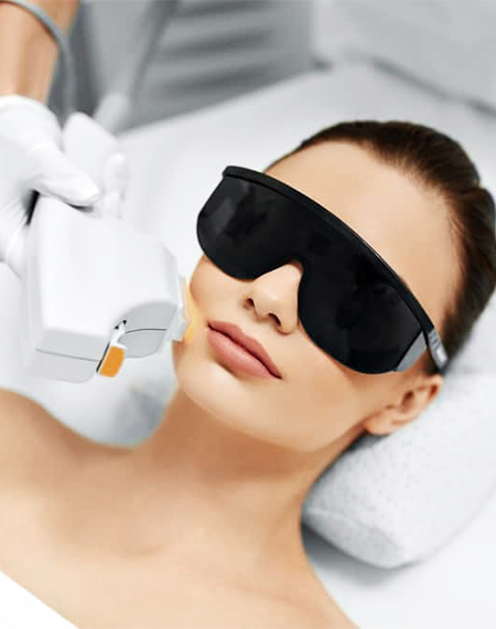 laser hair removal for face