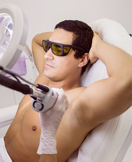 Laser Hair Removal for men for Arms